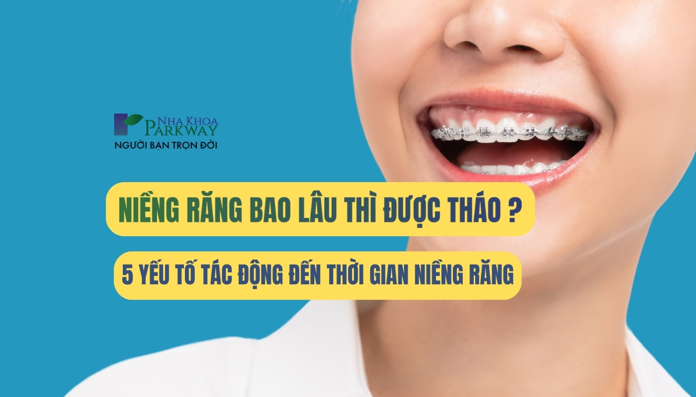 Niềng răng bao lâu thì được tháo?