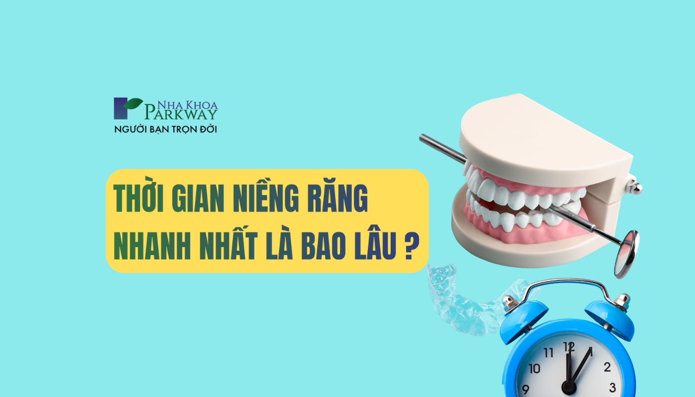 Niềng răng nhanh nhất bao lâu?