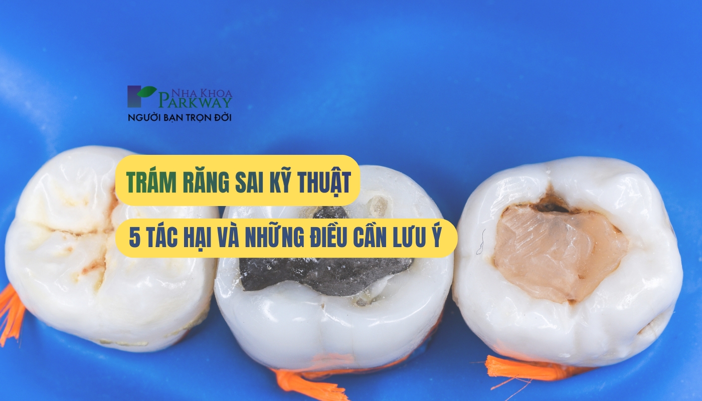 Tác hại khi trám răng sai kỹ thuật