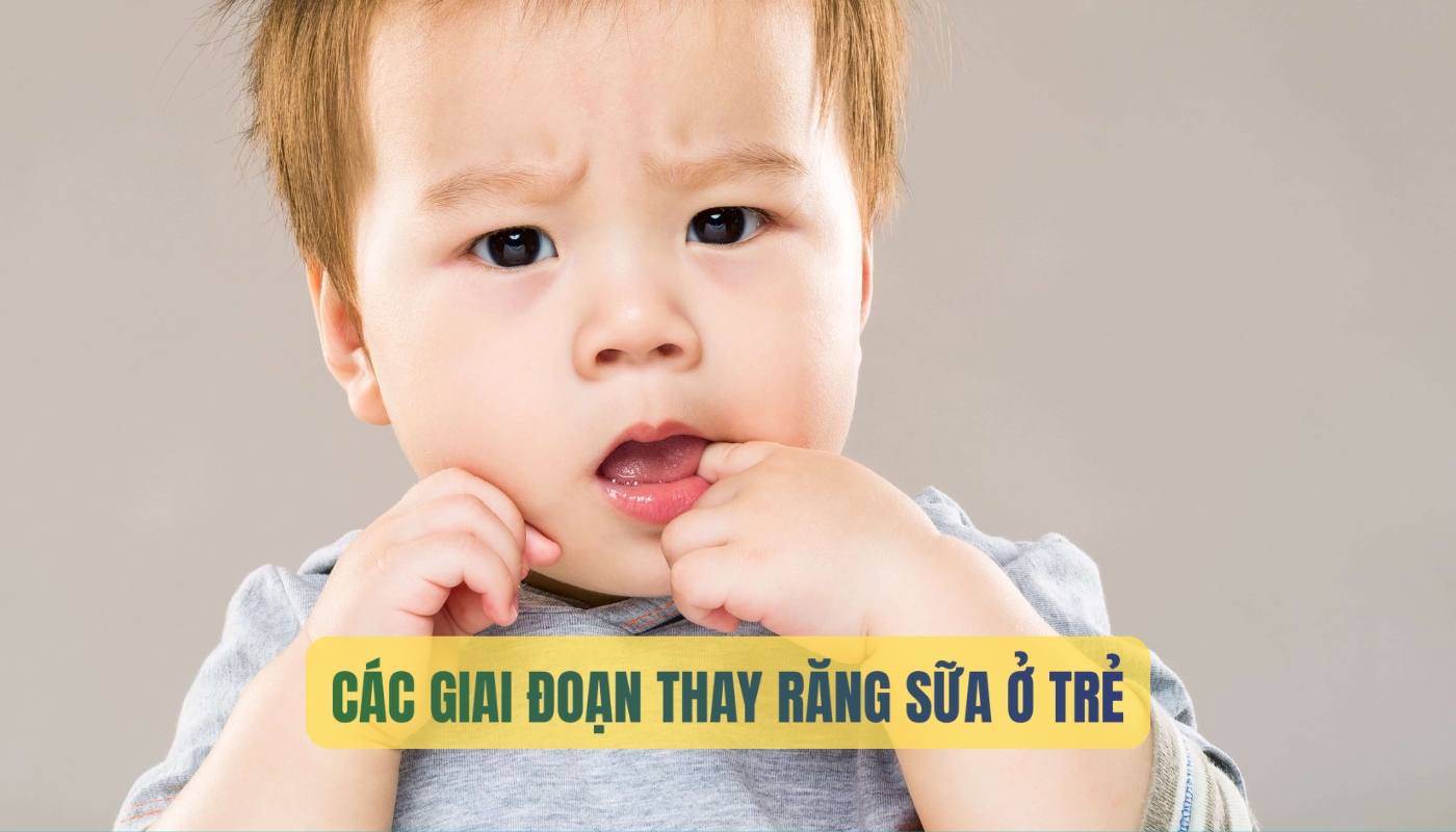 6 giai đoạn thay răng sữa