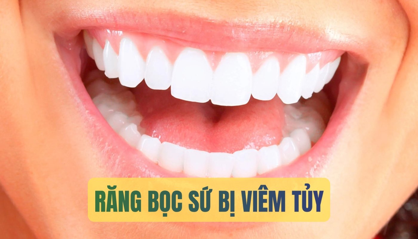 Răng bọc sứ bị viêm tủy