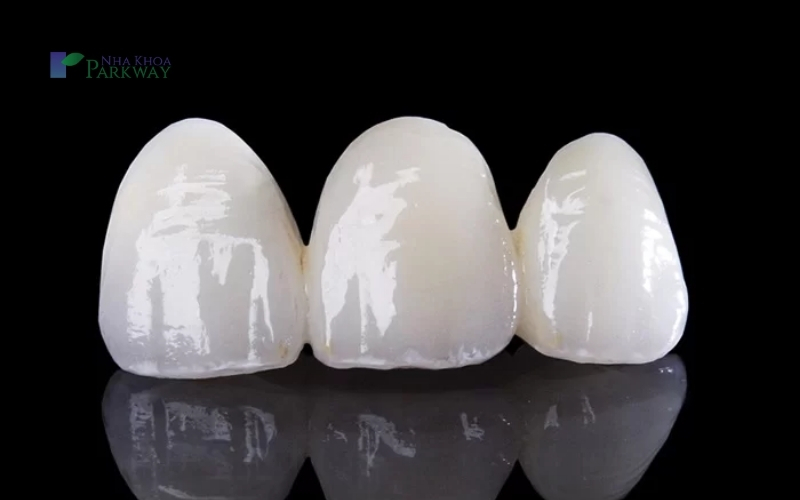 Răng toàn sứ được làm từ sứ nha khoa nguyên chất, độ bền cao và an toàn cho sức khỏe