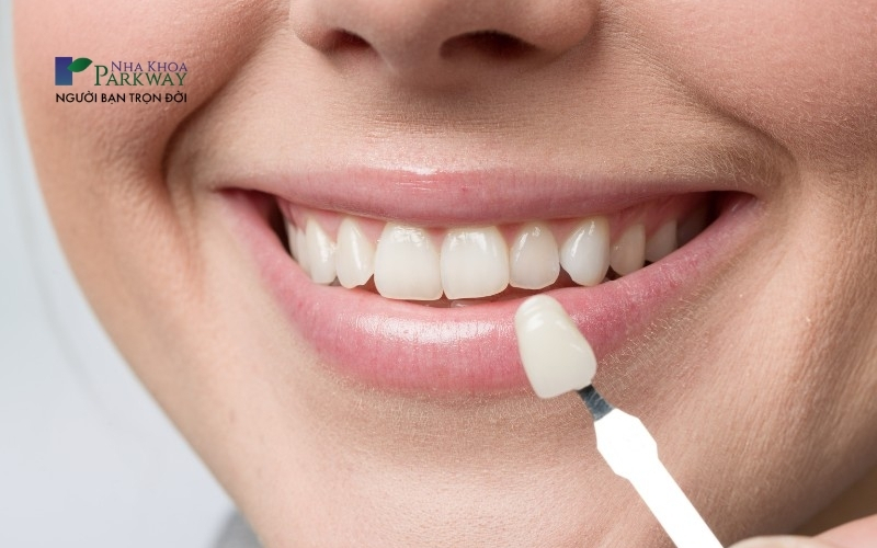 Một chiếc răng bọc sứ có độ bền lên đến 20 năm nếu được chăm sóc đúng cách