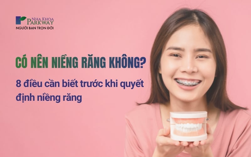 8 điều cần biết trước khi quyết định niềng răng