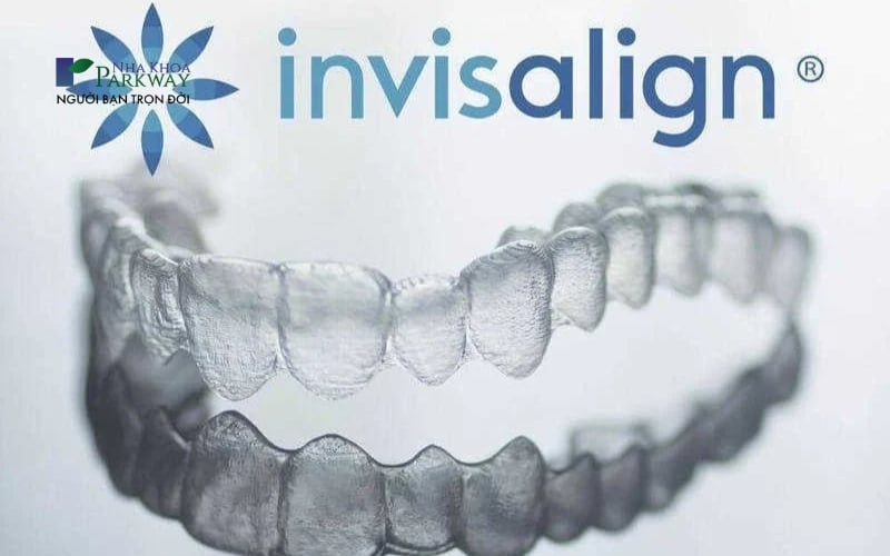 Phương pháp niềng răng trong suốt Invisalign có độ hiệu quả và thẩm mỹ cao