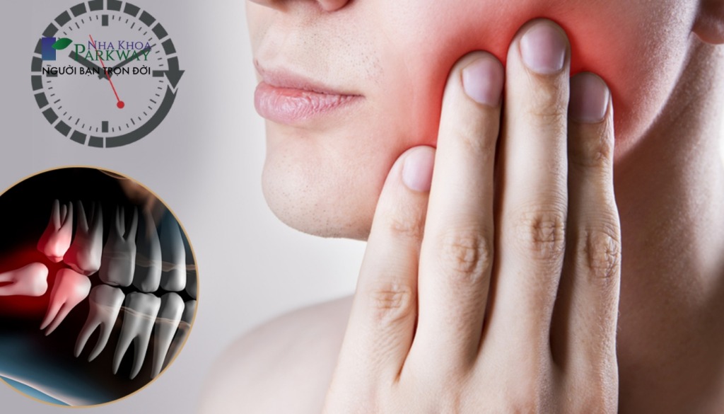 8 mẹo chữa đau răng tại nhà đơn giản mà hiệu quả bạn nên biết