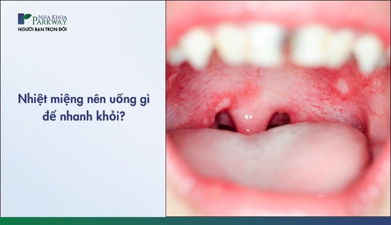 Nhiệt miệng uống gì nhanh khỏi