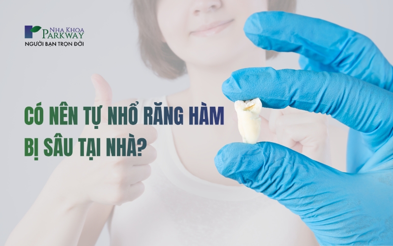 Có nên tự nhổ răng hàm bị sâu tại nhà không?