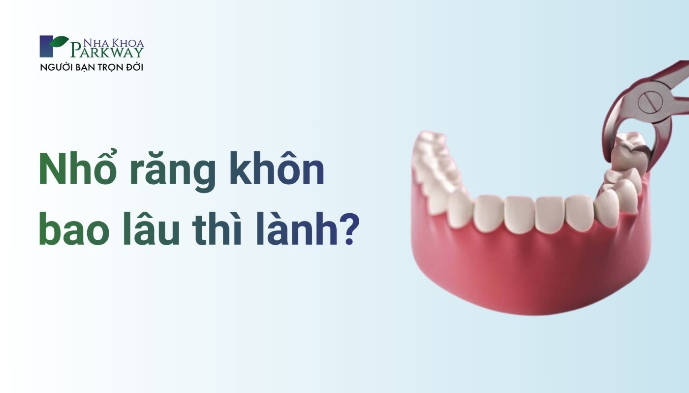 Nhổ răng khôn bao lâu thì lành? 4 yếu tố ảnh hưởng đến quá trình hồi phục vết thương sau khi nhổ răng khôn