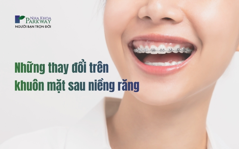 Sự thay đổi trên khuôn mặt sau niềng răng