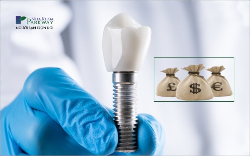 Trồng răng Implant có chi phí cao