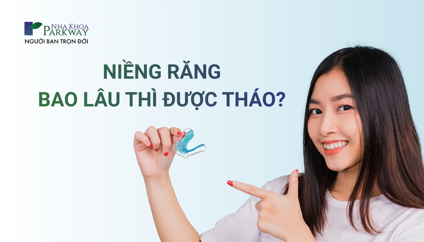 Niềng răng bao lâu thì được tháo