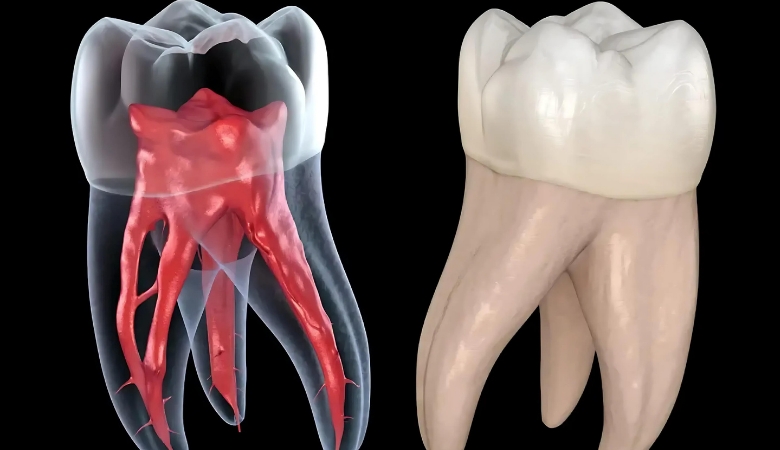 Hình ảnh rằng sau khi làm lại tủy