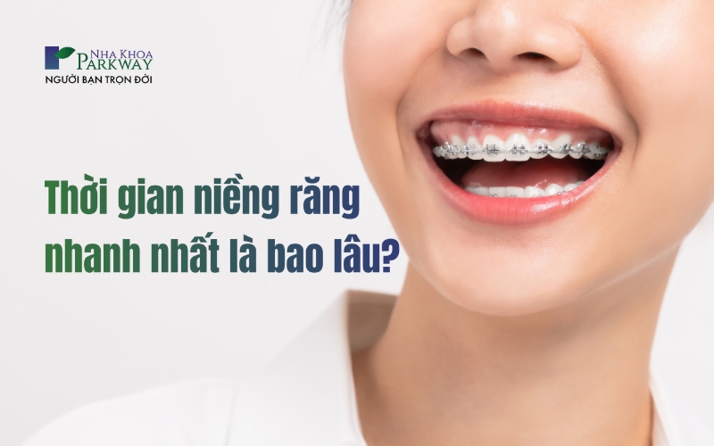 Niềng răng nhanh nhất là bao lâu?