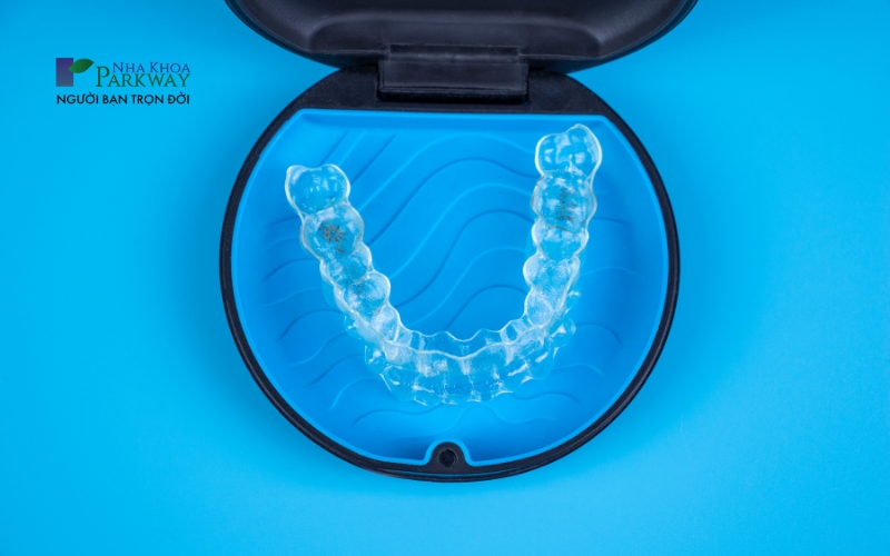 Thời gian niềng răng trong suốt Invisalign thường kéo dài từ 12 đến 18 tháng