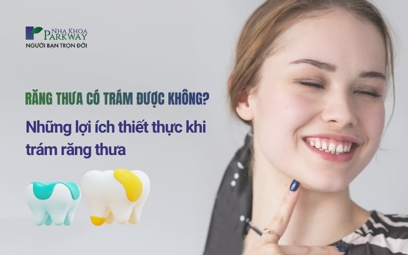 Trám răng thưa mang lại những lợi ích nào?