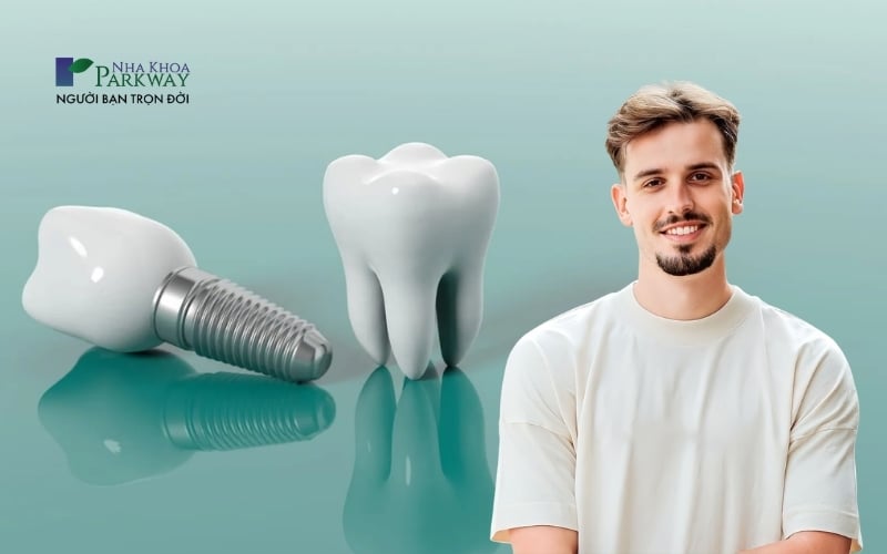 Ưu điểm của phương pháp trồng răng Implant All On 4