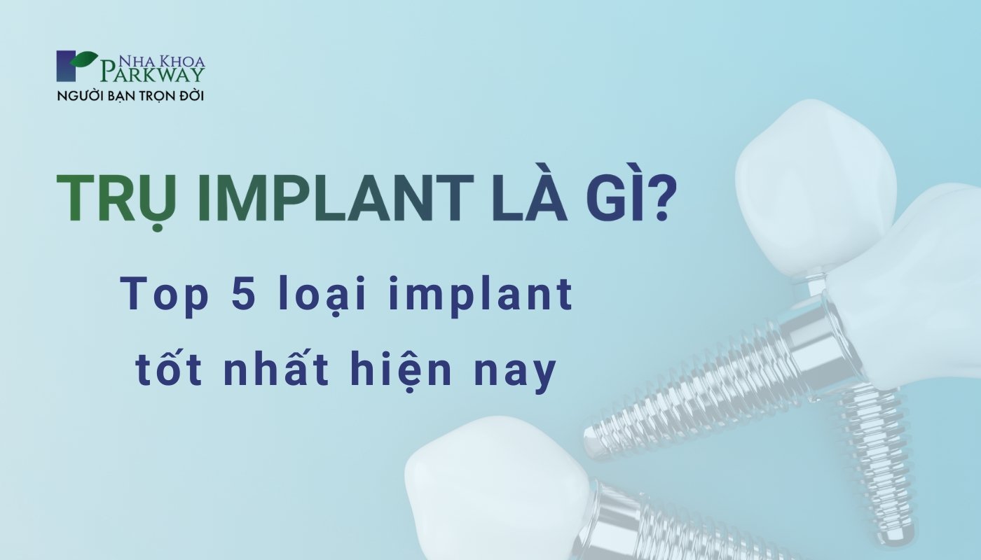 Trụ implant là gì? Top 5 loại implant tốt nhất hiện nay