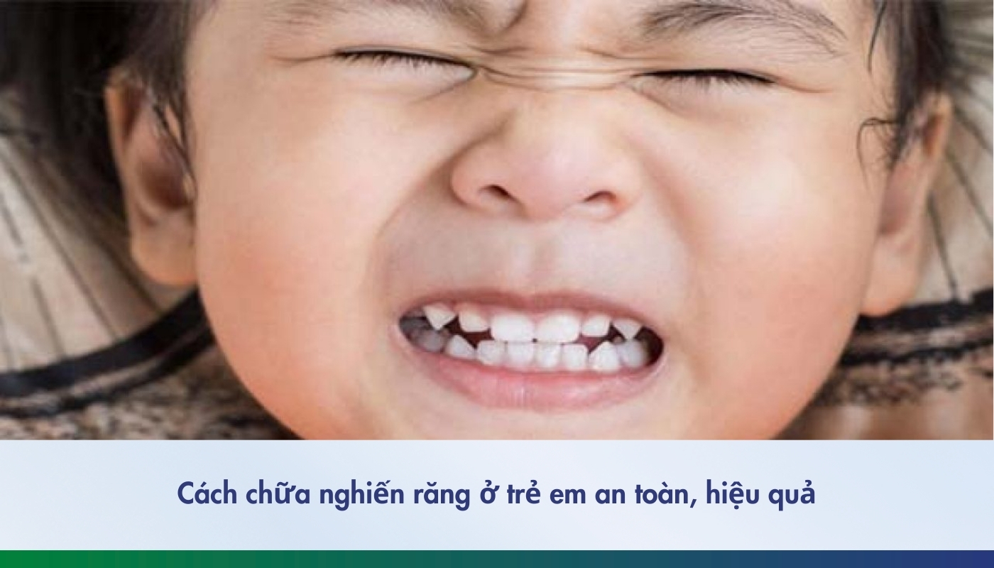 Cách chữa nghiến răng ở trẻ an toàn, hiệu quả