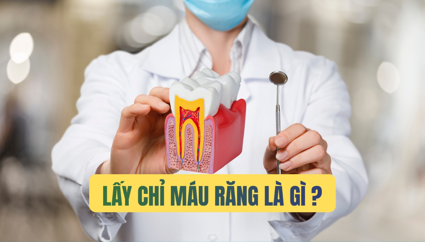 Lấy chỉ máu răng có đau không?