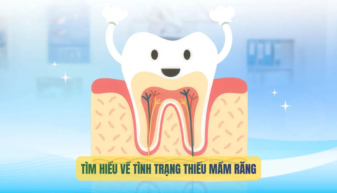 Tìm hiểu tình trạng thiếu mầm răng