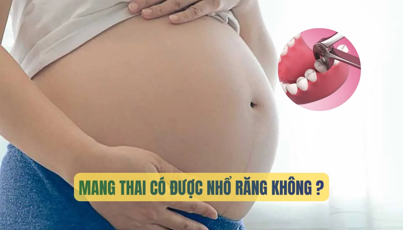 Có bầu nhổ răng được không