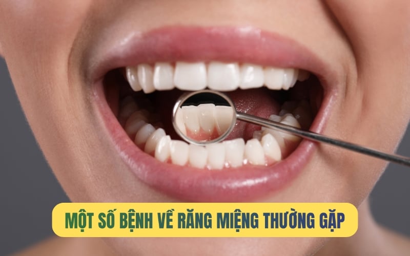 11 loại bệnh về răng miệng thường gặp