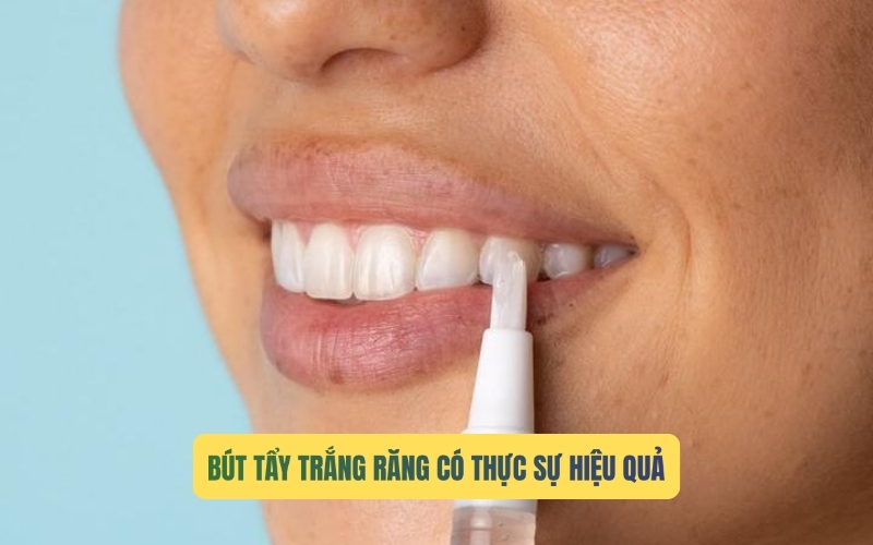 Những công dụng của bút tẩy trắng răng