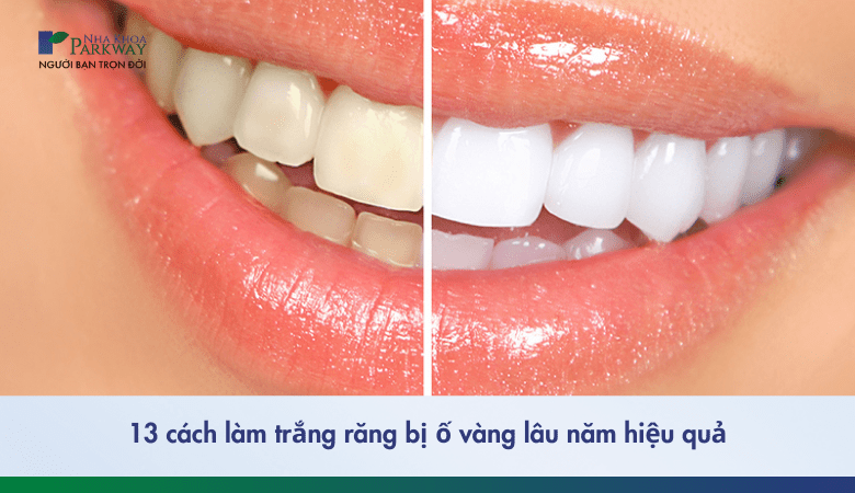 cách làm trắng răng bị ố vàng