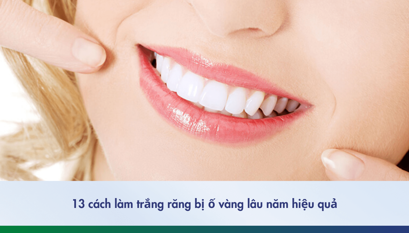 13 cách làm trắng răng bị ố vàng