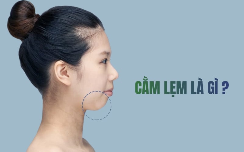 4 cách khắc phục cằm lẹm hiệu quả