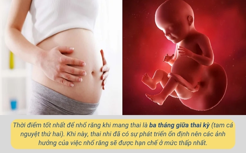 Thời điểm tốt nhất để bà bầu nhổ răng