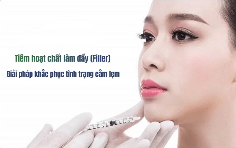 Tiêm filler khắc phục cằm lẹm