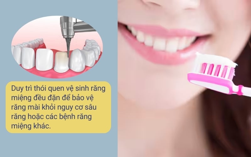 Duy trì thói quen vệ sinh răng miệng tốt sau khi mài răng ngắn lại