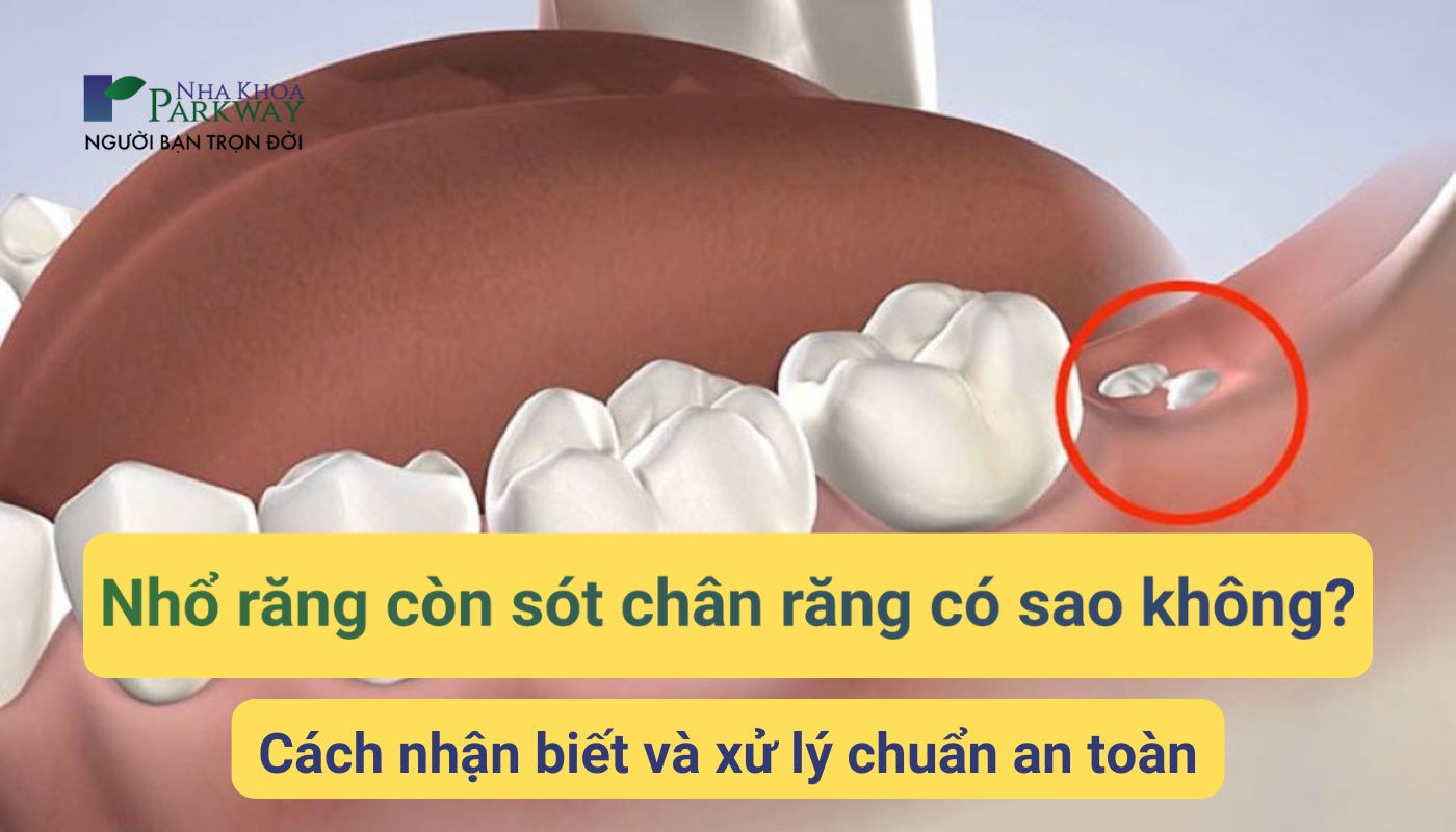 Nhổ răng còn sót chân răng có sao không