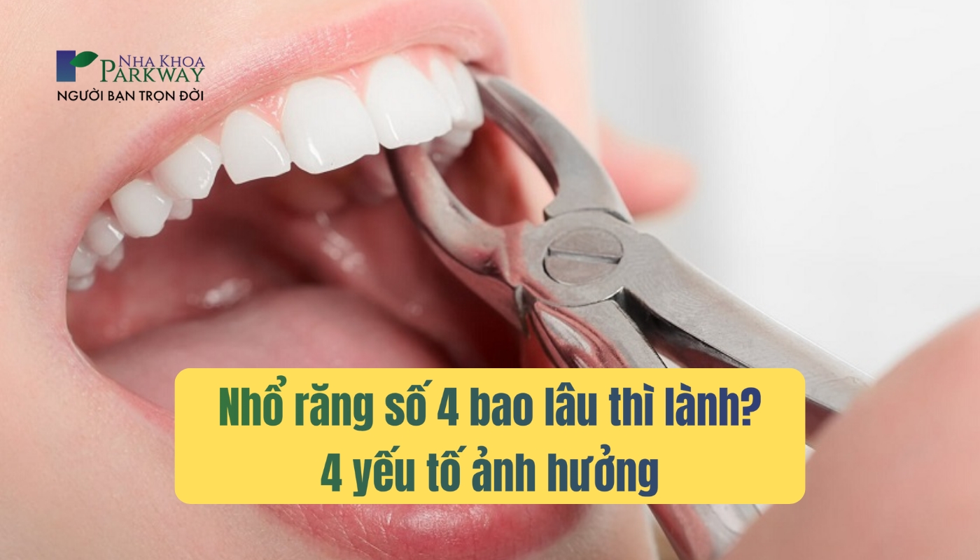 Nhổ răng số 4 bao lâu thì lành