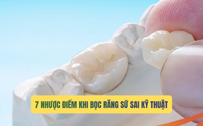 Nhược điểm của việc bọc răng sứ sai cách