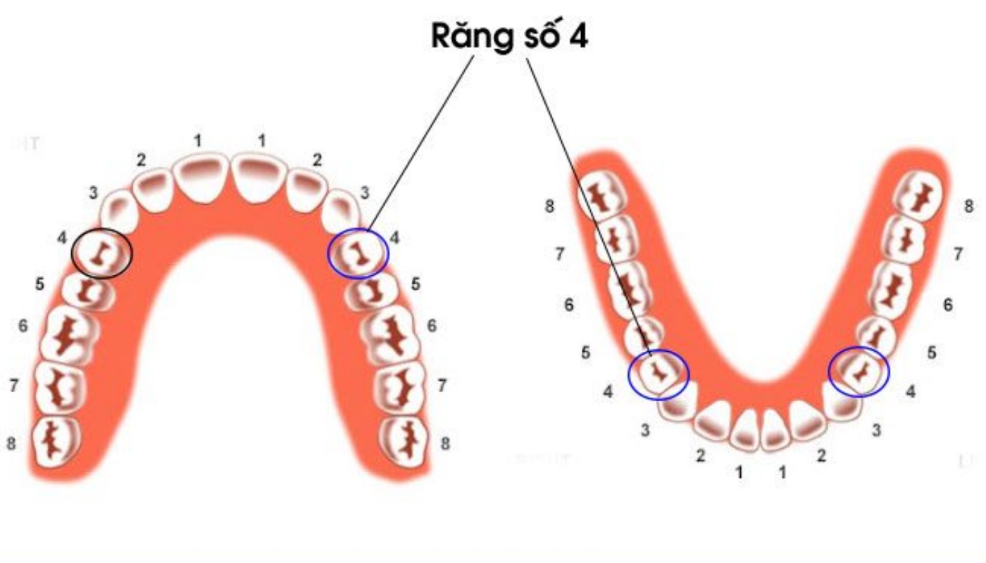 Hình ảnh vị trí răng ở cả hai hàm