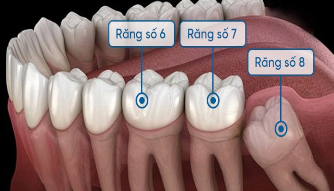 Hình ảnh mô phỏng vị trí răng số 7