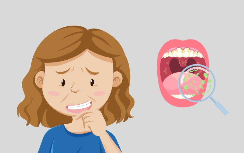 Bị nhiệt miệng liên tục do các loại vi khuẩn gây hại