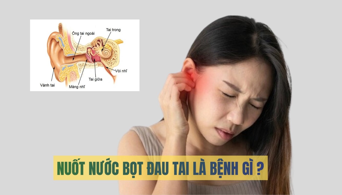 Nuốt nước bọt đau tai đau họng