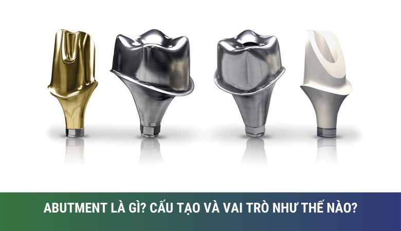 abutment là gì? Cấu tạo  và vai trò như thế nào?