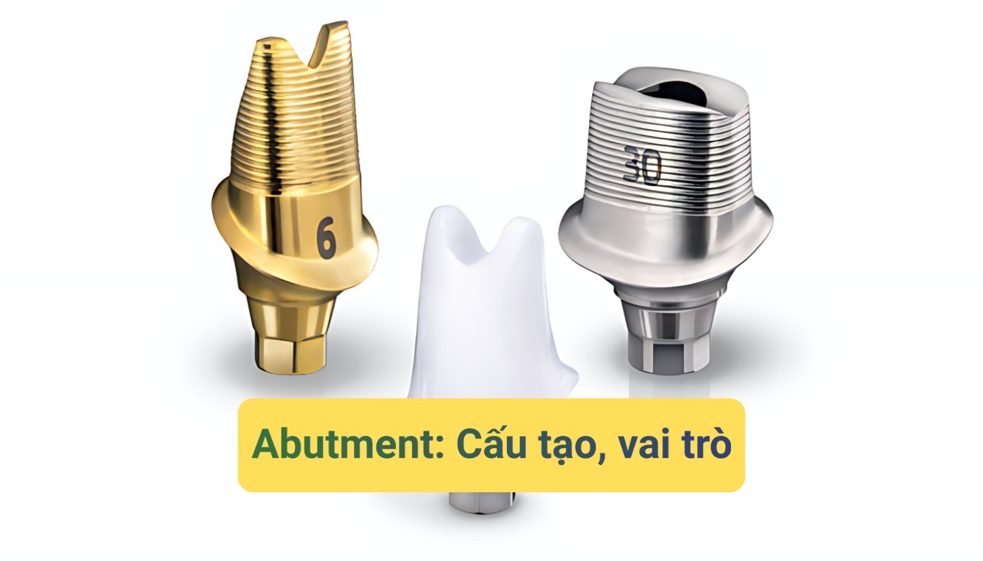 cấu tạo và vai trò abutment