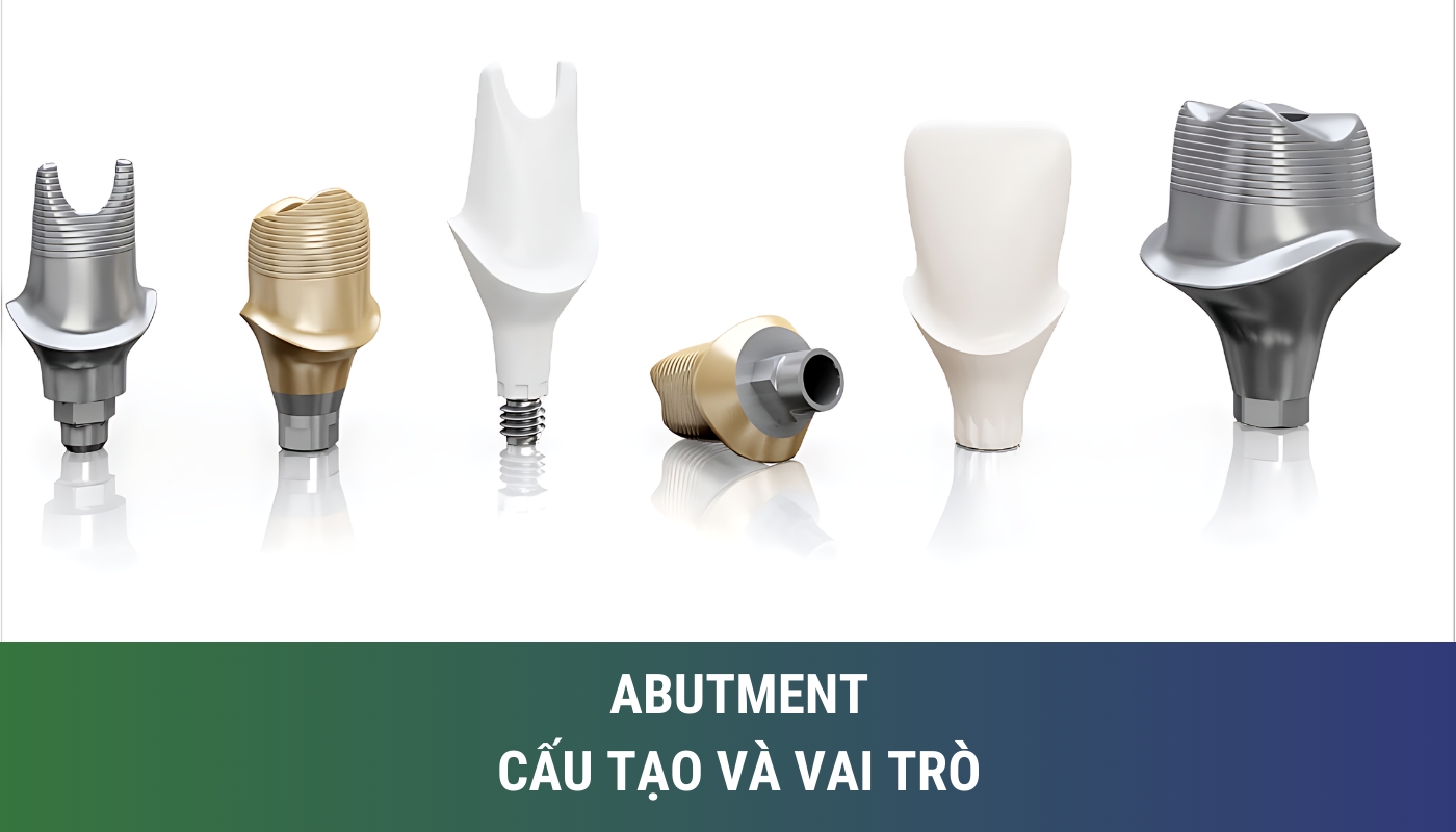 cấu tạo và vai trò của abutment