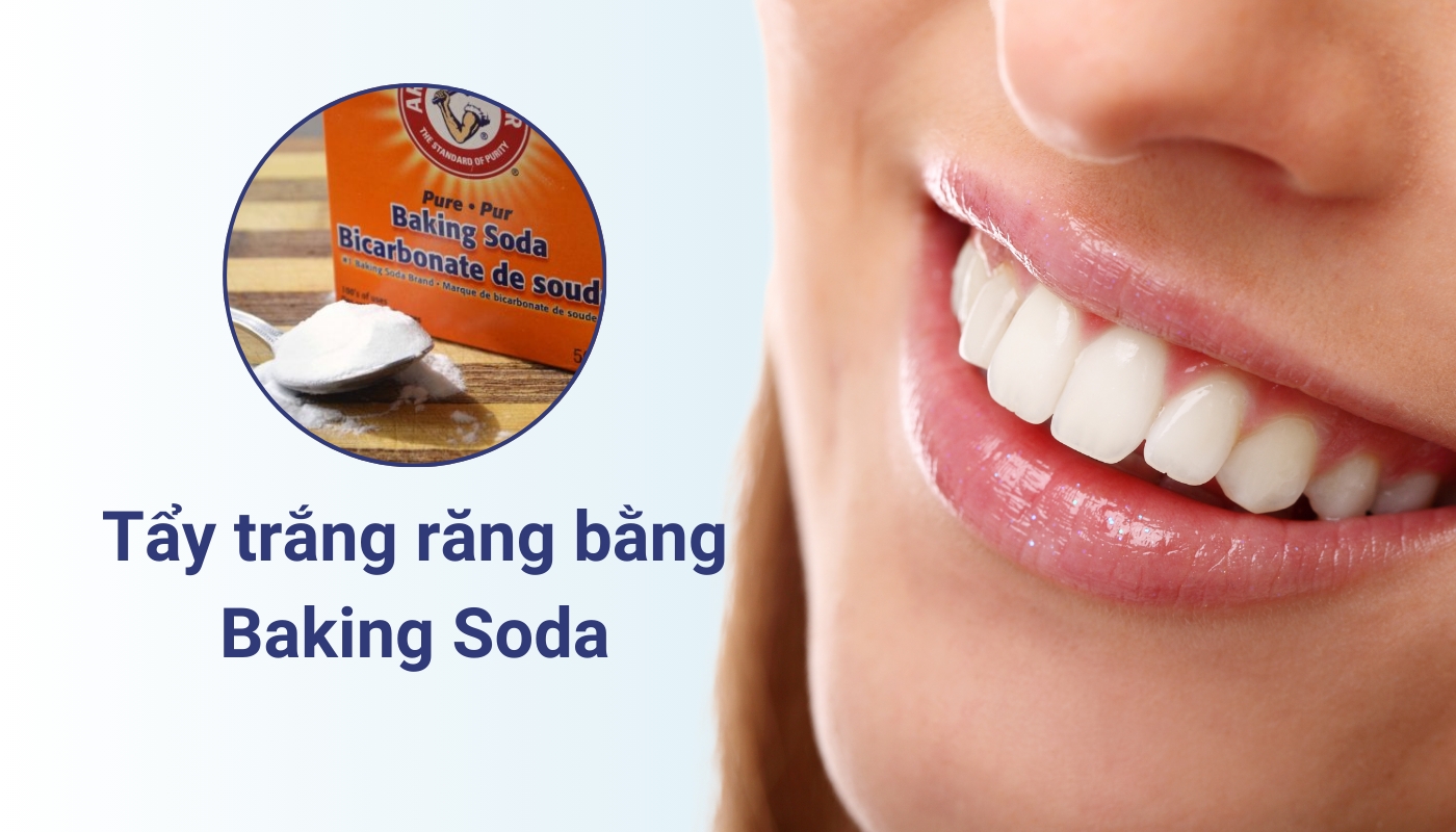 Baking soda tẩy trắng răng