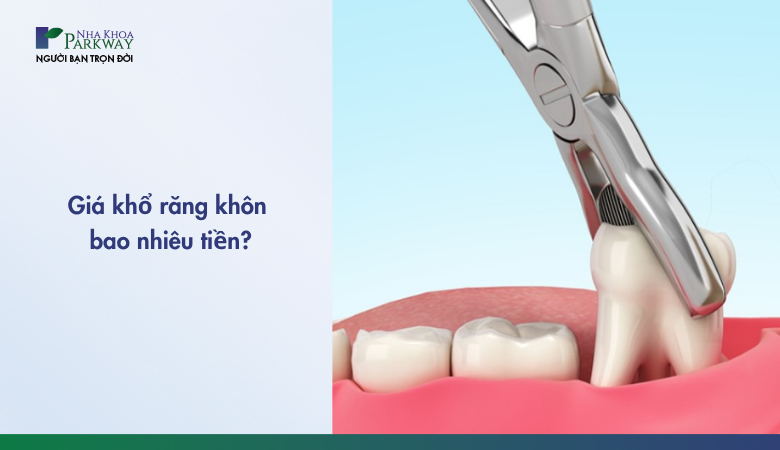 Giá nhổ răng khôn