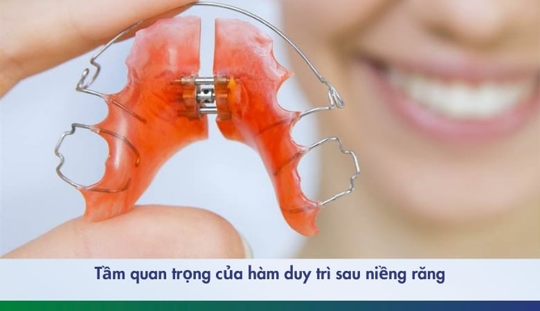 Hàm duy trì sau niềng răng - 1