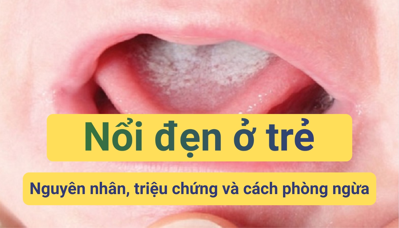 Nổi đẹn ở trẻ: Nguyên nhân, triệu chứng và cách phòng ngừa