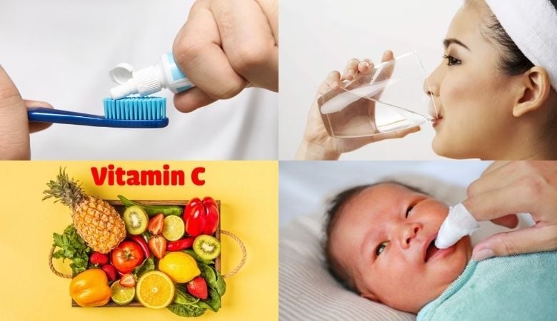 Chăm sóc và vệ sinh khoang miệng khi bị nổi mụn trắng nhưng không đau