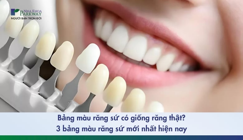 hình ảnh 3 bảng màu răng sứ